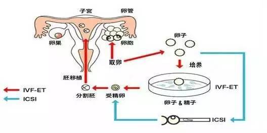 合肥试管婴儿